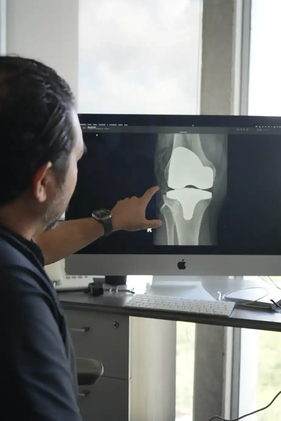 Dr. Ricardo Alejos revisa la radiografía de una rodilla en el monitor